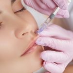 Things you need to know about Botox treatment